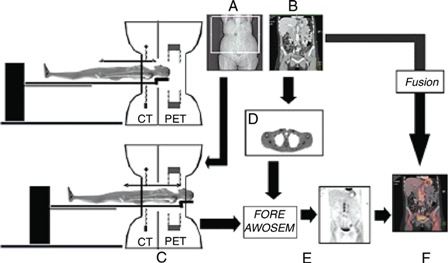 Pet+ct+scan+machine+cost