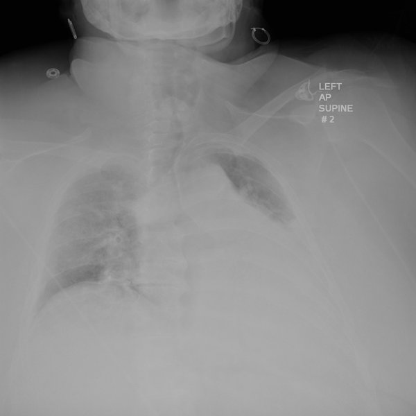 shuman fig.2