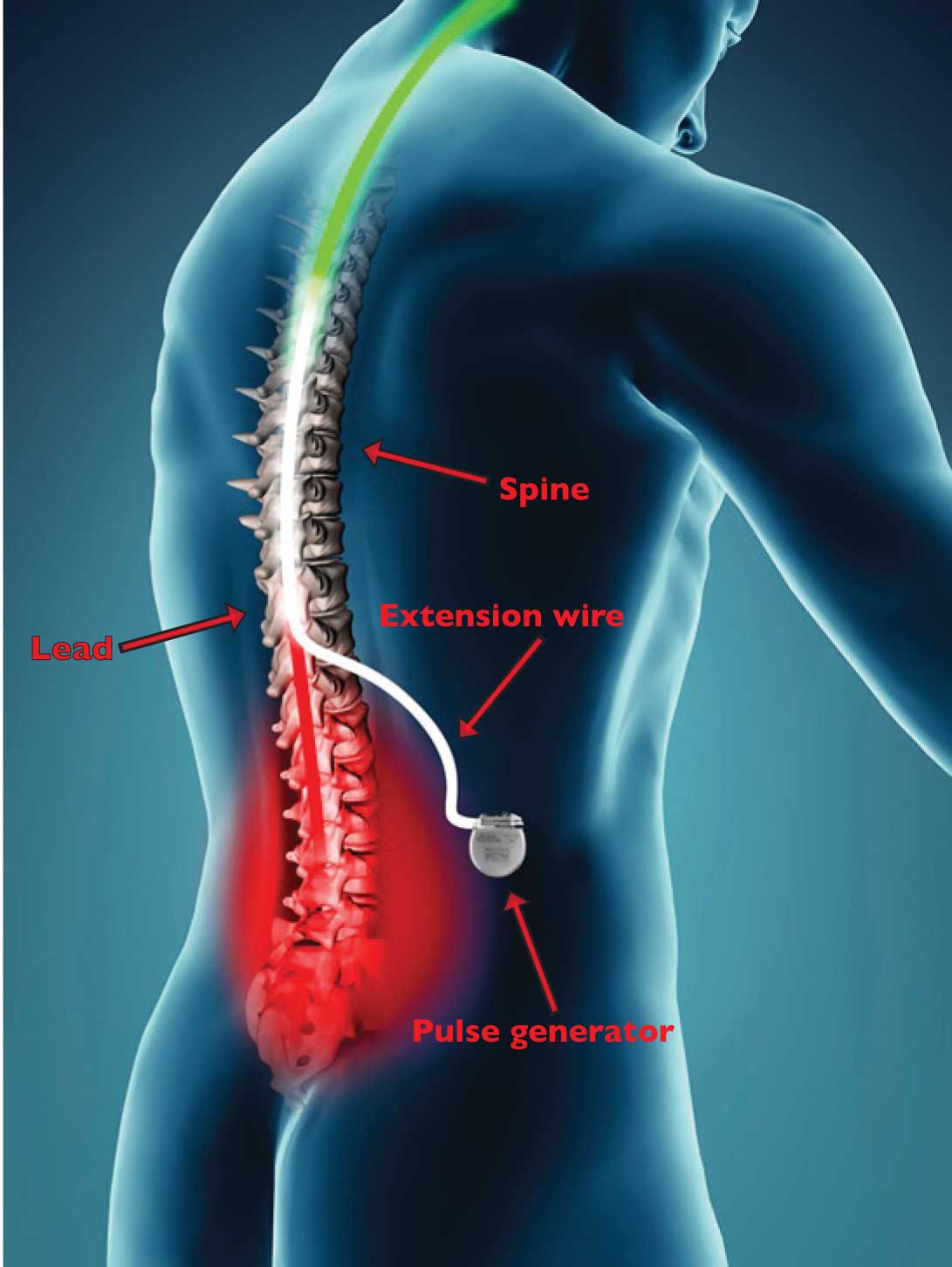 Sciatic Nerve Pain During Pregnancy - Penn Medicine Lancaster