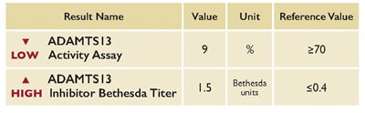 thrombocytopenia