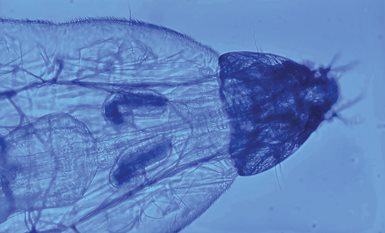 helminthiasis